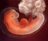 Эмбрион на 4 акушерскойнеделе